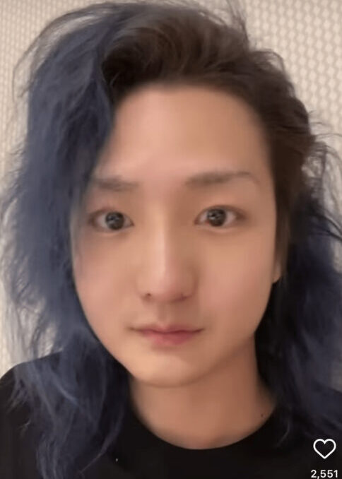 DJ社長の整形が大成功!ビフォーアフターの顔画像が別人でエグい!